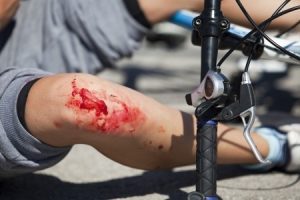 Cycling Accident Claims