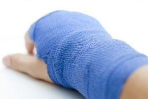A broken wrist in a blue cast