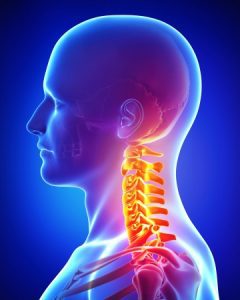 Neck Injuries