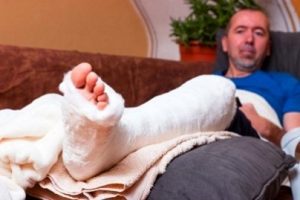 Broken leg