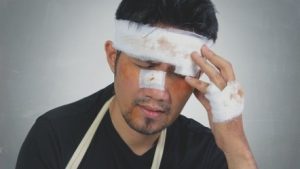 Concussion injury