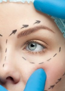 Botox negligence claims and botox injury claims 