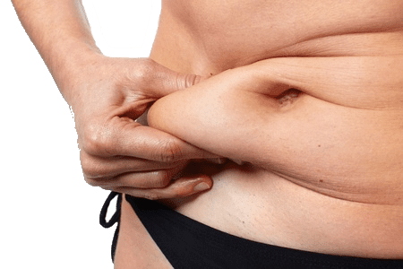 Tummy Tuck Negligence Claims Abdominoplasty Goes Wrong? How Much  Compensation? - Legal Expert - Get Free Advice