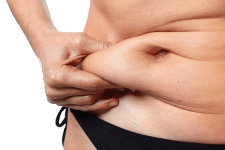Tummy Tuck Negligence Claims Abdominoplasty Goes Wrong? How Much Compensation? - Legal Expert - Get Free Advice