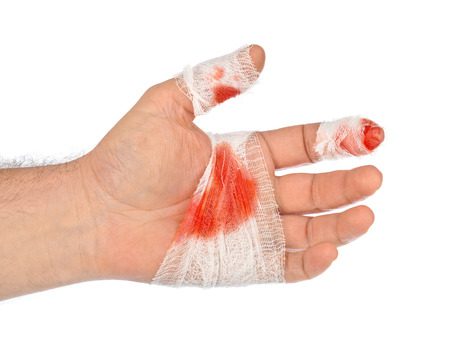 Lacerated Thumb Compensation Neenach thumbnail
