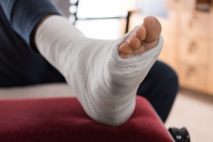 broken metatarsal and foot wrapped in bandages reclining on cushion