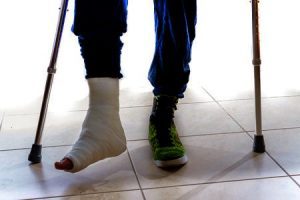 A man with his foot in plaster walking on crutches