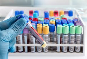 Blood tests in a medical setting.