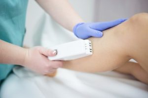 Laser Hair Removal Burns