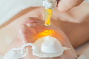 laser skin resurfacing claims 