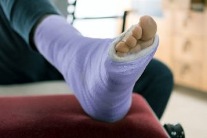 Person at home resting injured foot in a cast