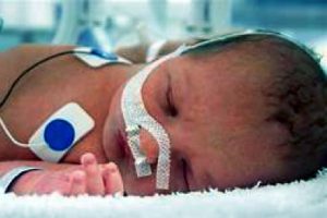 Childbirth brain injury