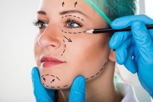 facelift injury negligence and facelift negligence claims