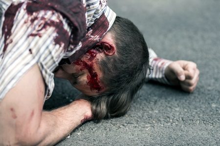 How Much Compensation Can I Claim For Being Stabbed?