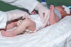 Midwife negligence claims