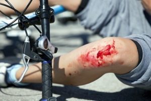 what to do if you have a cycle accident