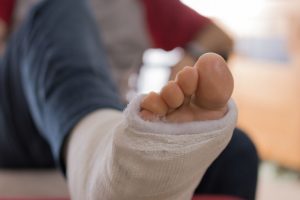 A foot in a plaster cast resting