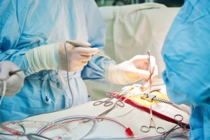 Unnecessary surgery compensation claims 