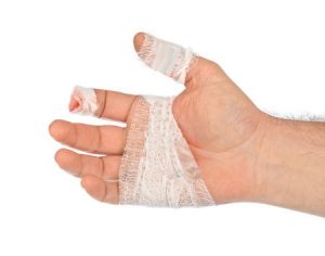 Partial finger amputation compensation claim guide