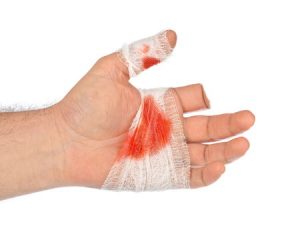 Cut off finger at work compensation claims guide