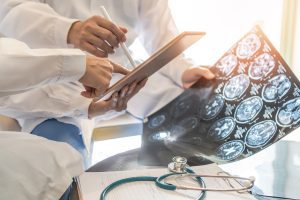 Two doctors look at a brain scan for further investigation. 