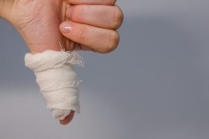 A bandaged thumb pointing down to show the major impact on lifestyle. 