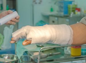 A hand wrapped in bandages as part of treating burns in a hospital. 