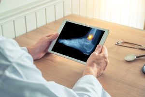 HEALTHCARE PROFESSIONAL LOOKING AT FOOT DAMAGE X-RAY ON A TABLET