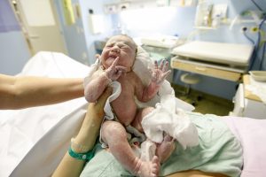 A newborn baby has been suffered brachial plexus injuries.