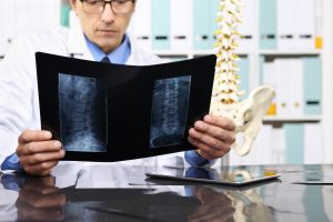 A doctor looks at x-ray images of a patient's lower back.
