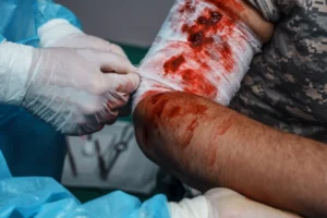 Medical staff address a soldier's bloodied bandage